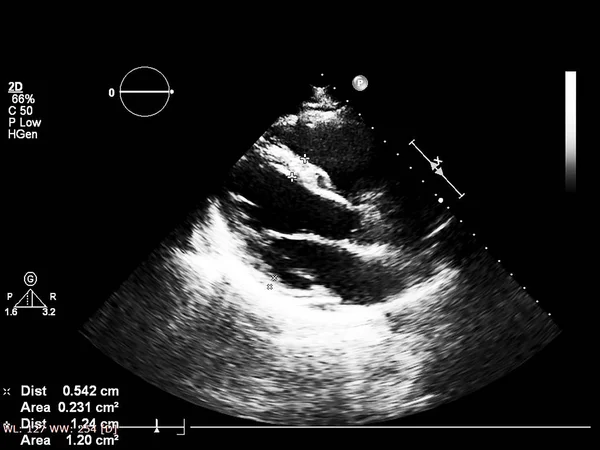 Écran de la machine d'échocardiographie (échographie) . — Photo