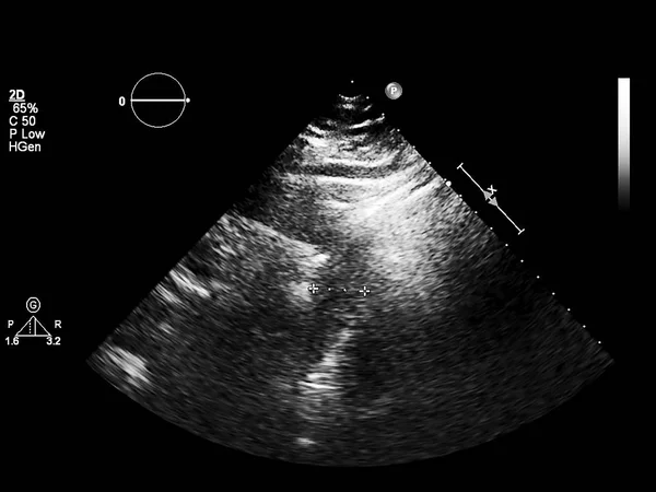 Pantalla de la máquina de ecocardiografía (ultrasonido) . —  Fotos de Stock