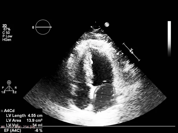 超声心动图（超声）机屏幕. — 图库照片