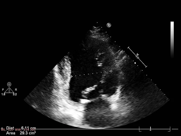 Οθόνη ηχοκαρδιογραφίας (υπερήχων) μηχανή. — Φωτογραφία Αρχείου