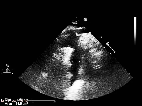 Tela da máquina de ecocardiografia (ultra-som) . — Fotografia de Stock