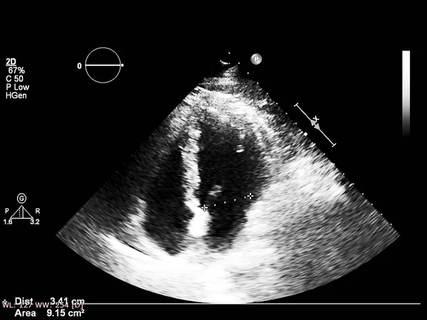 Mesin echocardiography (ultrasound) layar . — Stok Foto