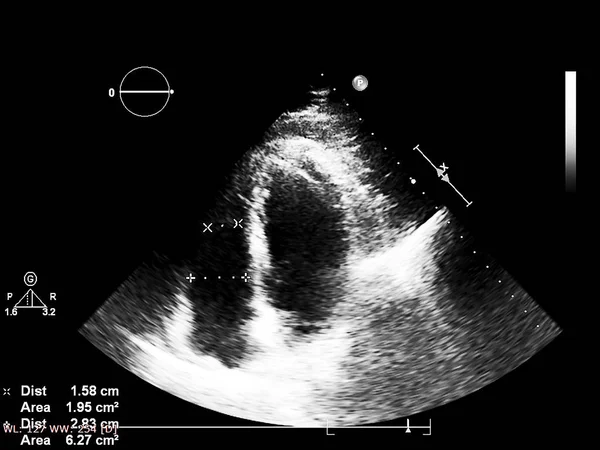 Écran de la machine d'échocardiographie (échographie) . — Photo