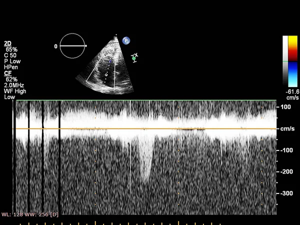 Skärm av ekokardiografi (ultraljud) maskin. — Stockfoto