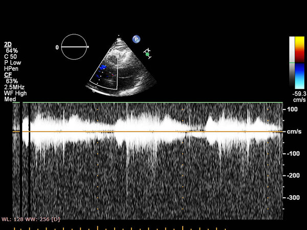 Экран эхокардиографической (ультразвуковой) машины
.