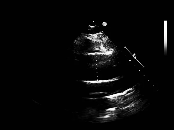 Pantalla de la máquina de ecocardiografía (ultrasonido) . —  Fotos de Stock