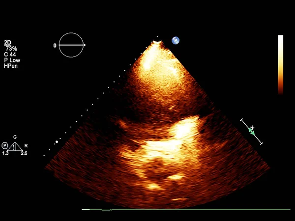 Tela da máquina de ecocardiografia (ultra-som) . — Fotografia de Stock