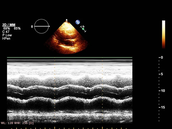 Bildschirm der Echokardiographie (Ultraschall) Maschine. — Stockfoto