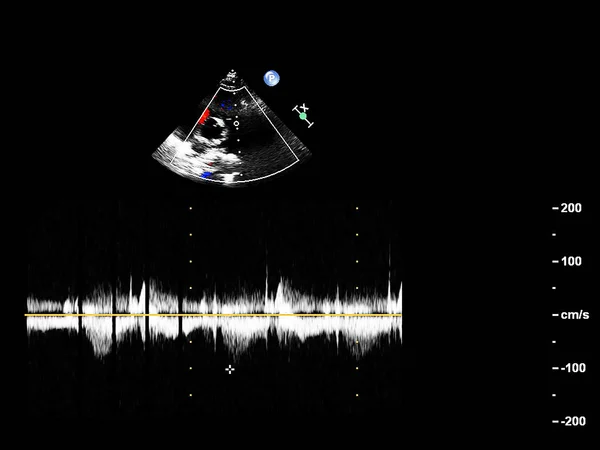 Tela da máquina de ecocardiografia (ultra-som) . — Fotografia de Stock