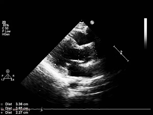 Écran de la machine d'échocardiographie (échographie) . — Photo