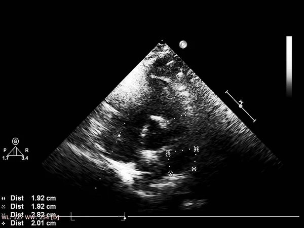 Skärm av ekokardiografi (ultraljud) maskin. — Stockfoto