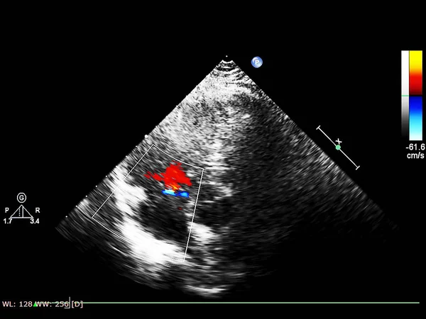 Tela da máquina de ecocardiografia (ultra-som) . — Fotografia de Stock