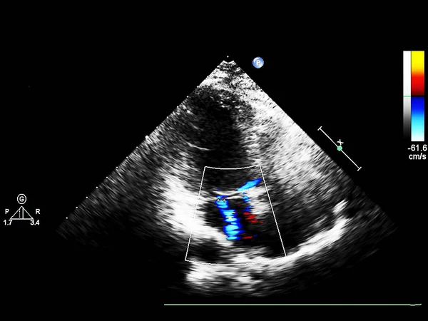 Экран эхокардиографической (ультразвуковой) машины . — стоковое фото