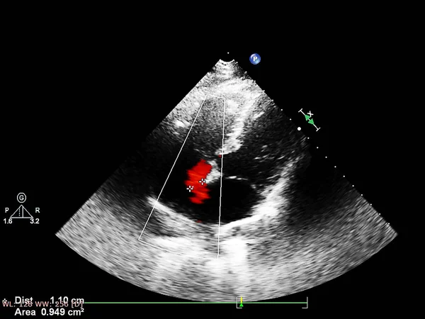 Scherm van echocardiografie (echografie) machine. — Stockfoto