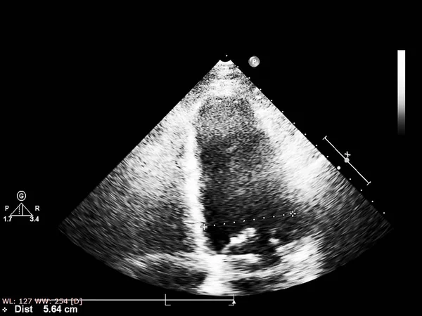 Tela da máquina de ecocardiografia (ultra-som) . — Fotografia de Stock