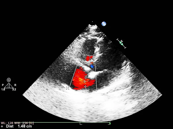 Skärm av ekokardiografi (ultraljud) maskin. — Stockfoto