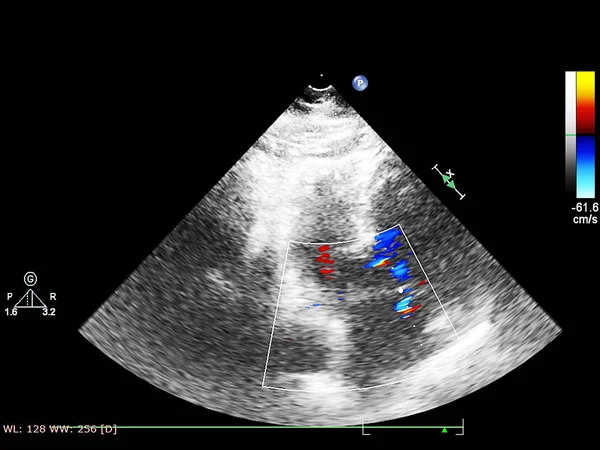 Pantalla de la máquina de ecocardiografía (ultrasonido) . — Foto de Stock