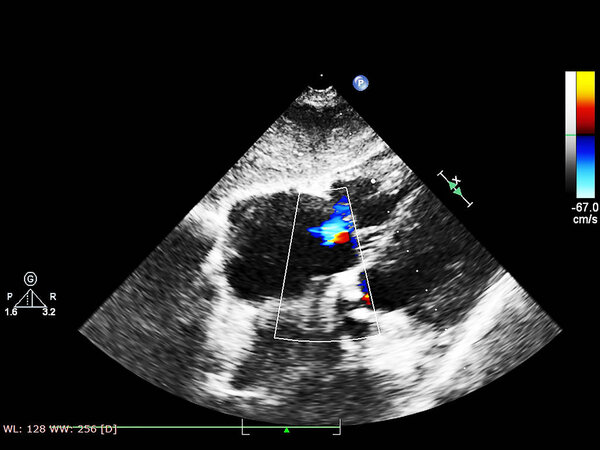 Экран эхокардиографической (ультразвуковой) машины
.