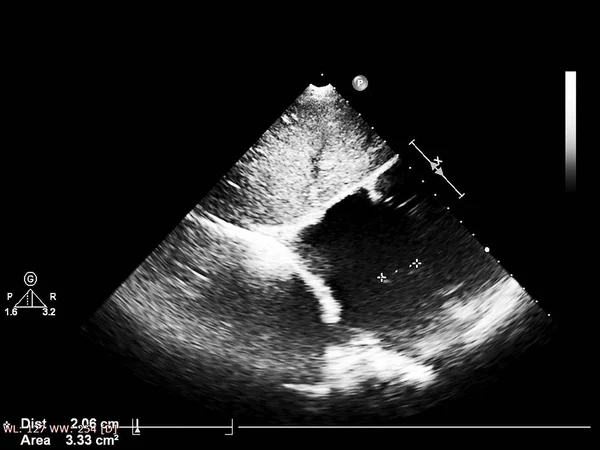 Tela da máquina de ecocardiografia (ultra-som) . — Fotografia de Stock