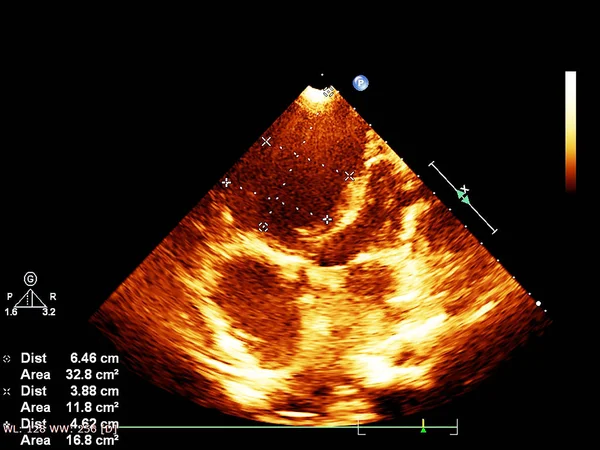 Bildschirm der Echokardiographie (Ultraschall) Maschine. — Stockfoto