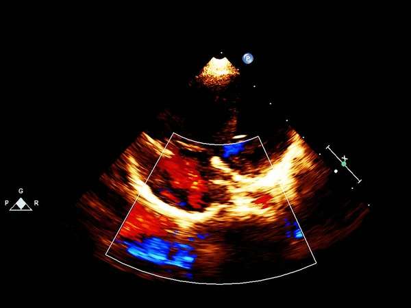 Pantalla de la máquina de ecocardiografía (ultrasonido) . — Foto de Stock