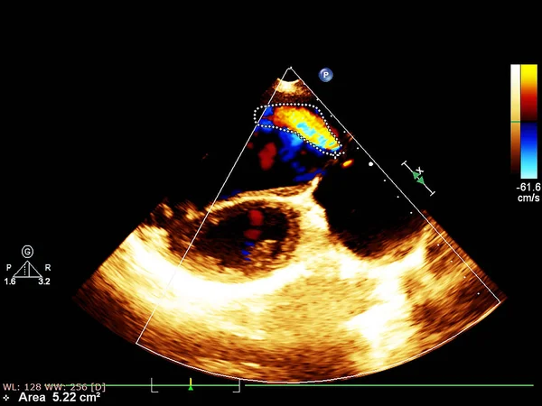 心エコー検査(超音波)マシンの画面. — ストック写真