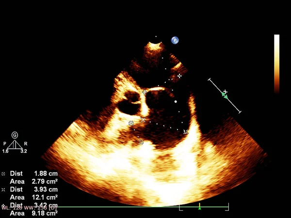 Skärm av ekokardiografi (ultraljud) maskin. — Stockfoto