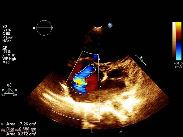 Tela da máquina de ecocardiografia (ultra-som) . — Fotografia de Stock