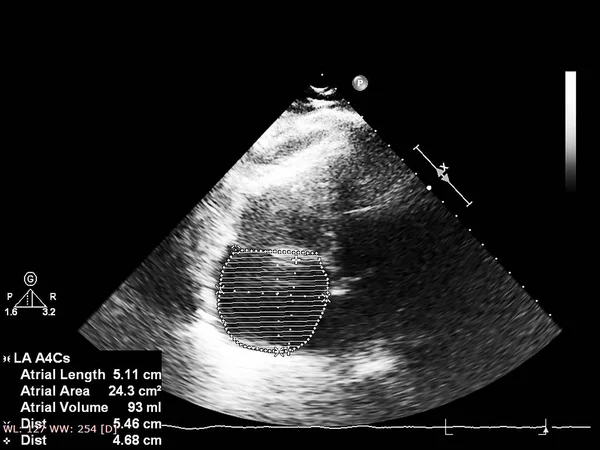 Экран эхокардиографической (ультразвуковой) машины . — стоковое фото