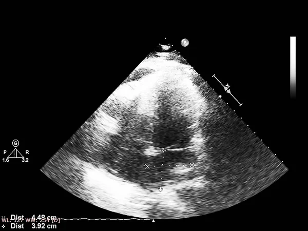 Tela da máquina de ecocardiografia (ultra-som) . — Fotografia de Stock