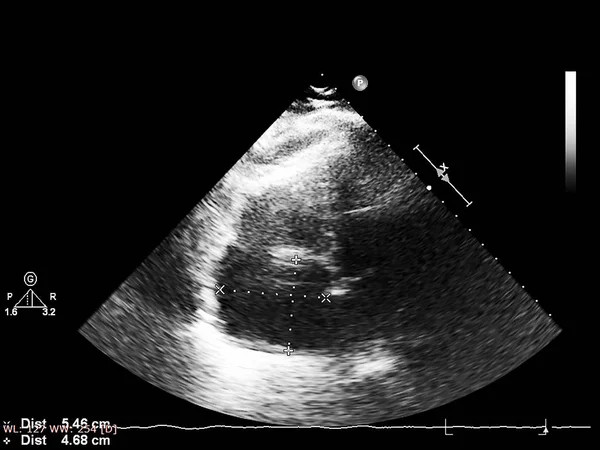 Écran de la machine d'échocardiographie (échographie) . — Photo