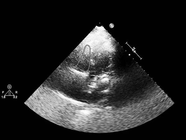 Pantalla de la máquina de ecocardiografía (ultrasonido) . —  Fotos de Stock