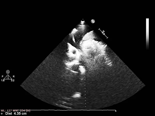 Tela da máquina de ecocardiografia (ultra-som) . — Fotografia de Stock