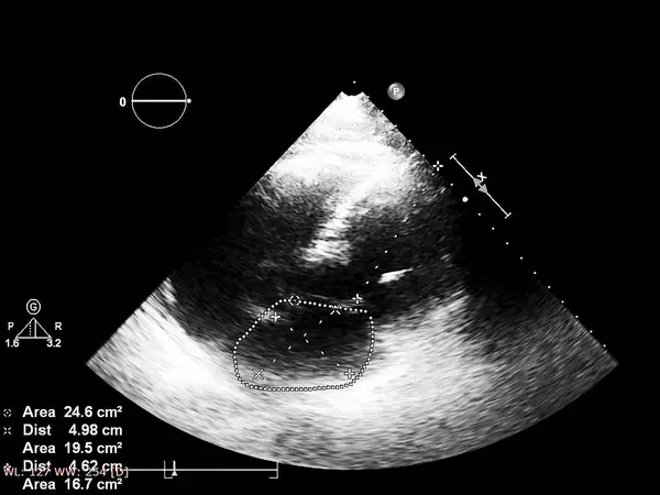 超声心动图（超声）机屏幕. — 图库照片