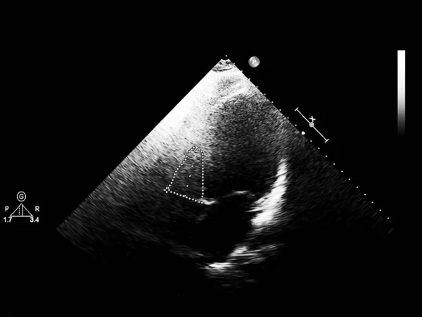 Skärm av ekokardiografi (ultraljud) maskin. — Stockfoto