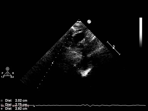 Tela da máquina de ecocardiografia (ultra-som) . — Fotografia de Stock