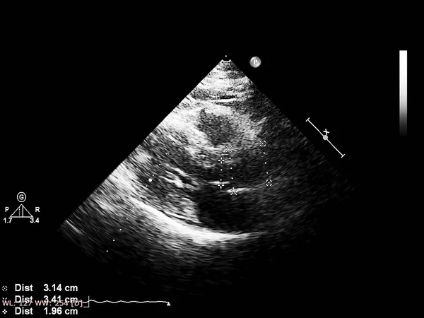 Tela da máquina de ecocardiografia (ultra-som) . — Fotografia de Stock