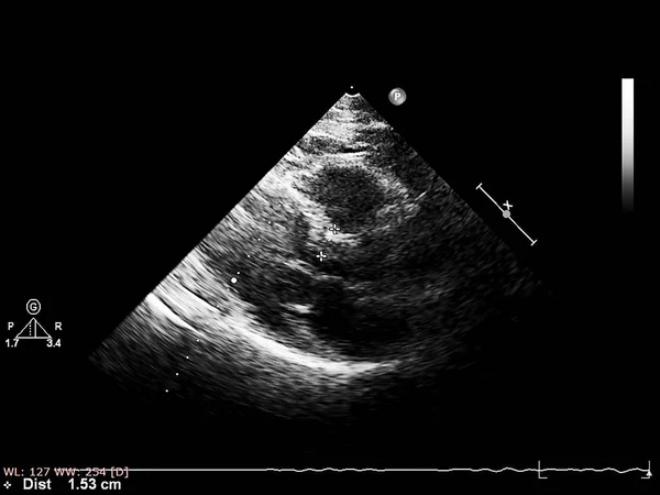 Mesin echocardiography (ultrasound) layar . — Stok Foto