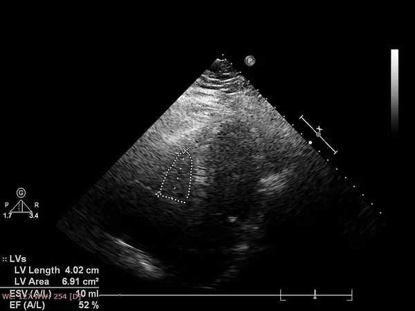 Tela da máquina de ecocardiografia (ultra-som) . — Fotografia de Stock