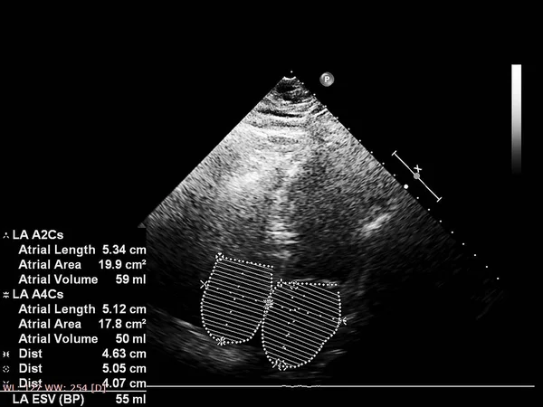 Bildschirm der Echokardiographie (Ultraschall) Maschine. — Stockfoto