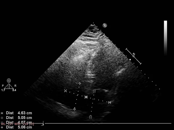 Pantalla de la máquina de ecocardiografía (ultrasonido) . — Foto de Stock