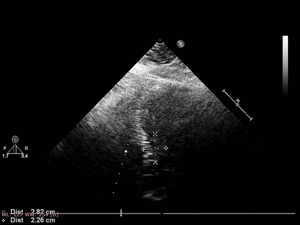 Οθόνη ηχοκαρδιογραφίας (υπερήχων) μηχανή. — Φωτογραφία Αρχείου