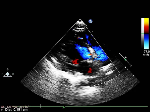 Pantalla de la máquina de ecocardiografía (ultrasonido) . —  Fotos de Stock