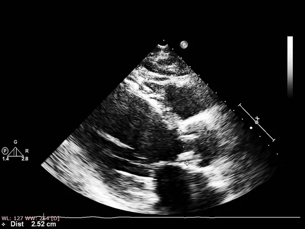 Tela da máquina de ecocardiografia (ultra-som) . — Fotografia de Stock