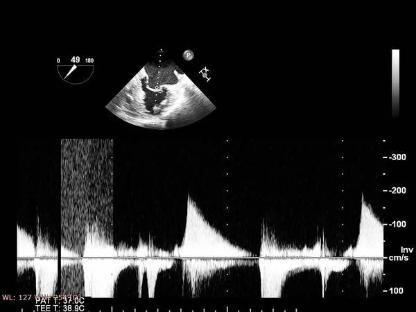 Tela da máquina de ecocardiografia (ultra-som) . — Fotografia de Stock