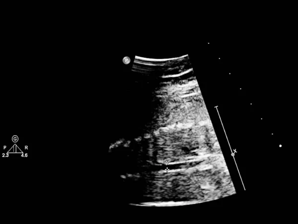 Ekran USG z echokardiografią płodu. — Zdjęcie stockowe