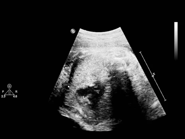 Schermo a ultrasuoni con ecocardiografia fetale . — Foto Stock