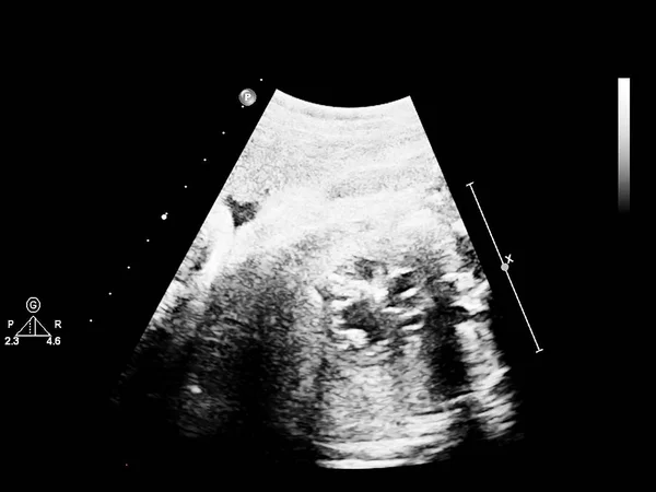 Ultrasound screen with fetal echocardiography. — Stock Photo, Image