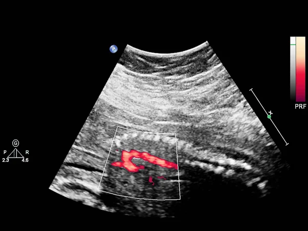 Ultrazvuková obrazovka s fetální echokardiografií. — Stock fotografie