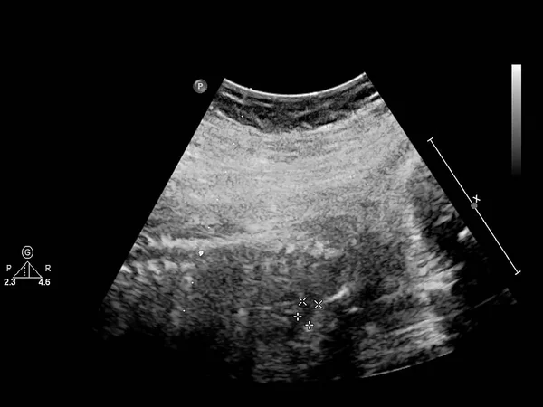 Ultrasound screen with fetal echocardiography. — Stock Photo, Image